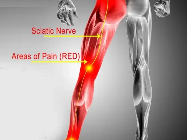 Part 1 – Chiropractor in Campbell CA Discusses Sciatica & Back Pain <small>#Sciatica #BackPain #BayAreaDiscCenters</small> Part 1 – Chiropractor in Campbell CA Discusses Sciatica & Back Pain <small>#Sciatica #BackPain #BayAreaDiscCenters</small>