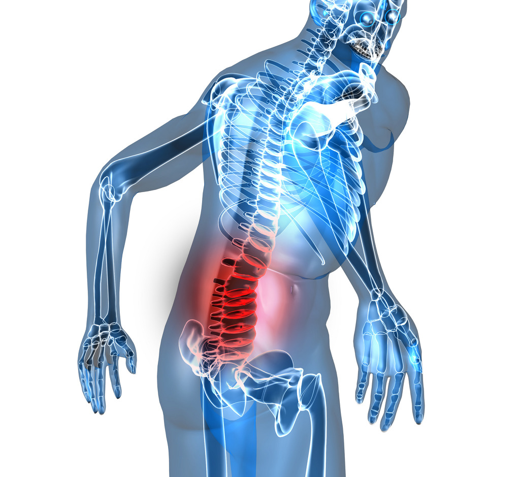 Lower-Back-Pain-3D - Bay Area Disc Center